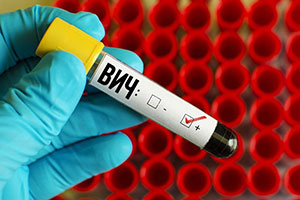 Сдать анализ крови на вич и гепатит цена в екатеринбурге thumbnail